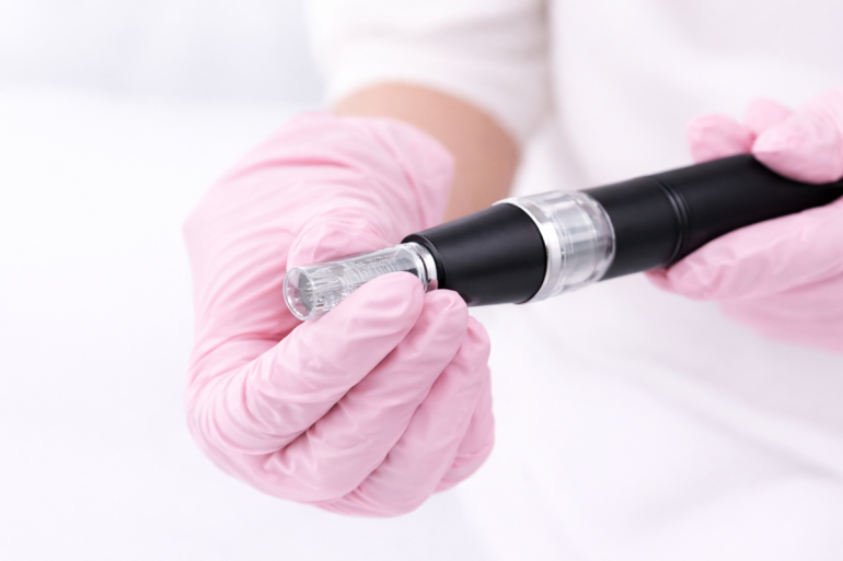 Microneedling