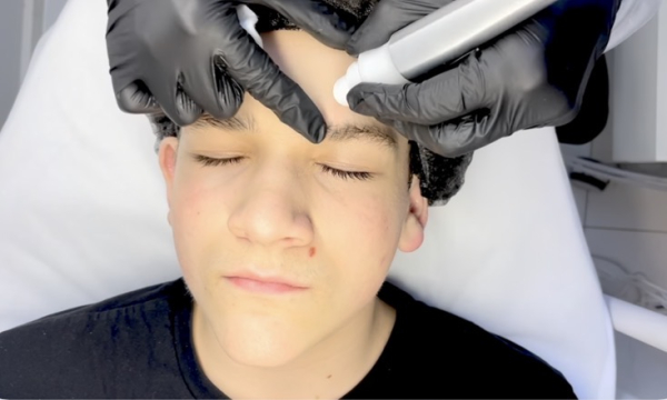 Hydrogen facial – who it’s for and what results to expect