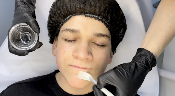 Kwasy na twarz – jak działają i czym różnią się AHA, BHA i PHA