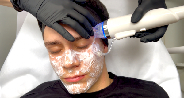 RF microneedling – what really happens in the skin